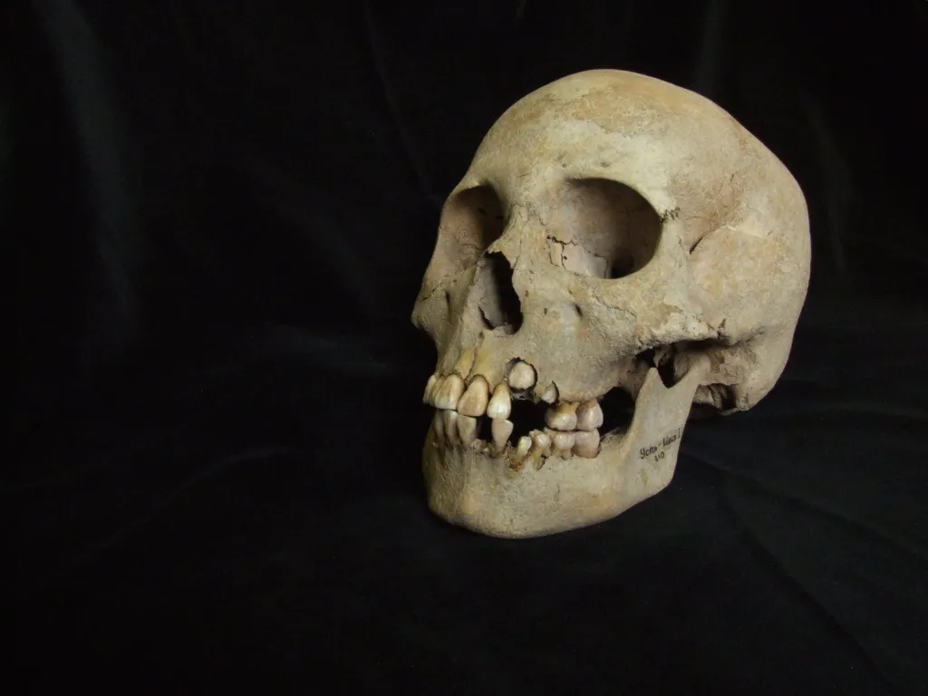 Skull of a young girl buried with plague victims in Siberia.
