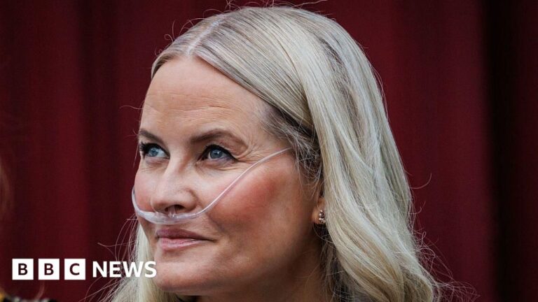 Norway’s crown princess undergoes successful lung transplant, palace says