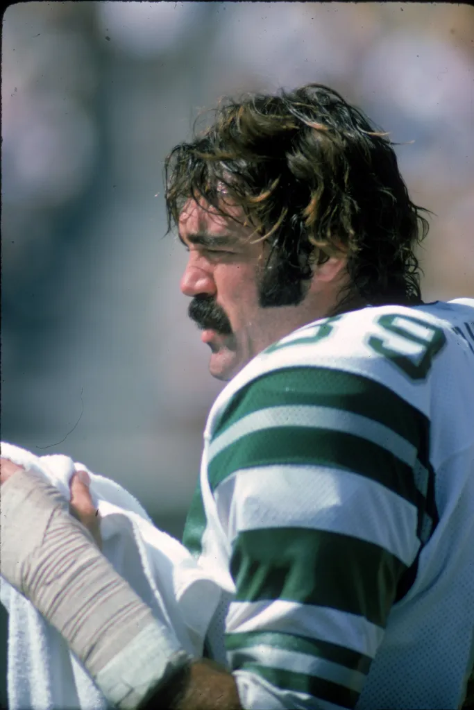 A Philadelphia Eagles player in a green and white striped jersey, with a mustache and sideburns, his hair disheveled, and a bandaged arm.